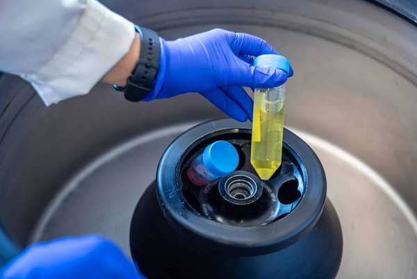 Quelle est la meilleure centrifugeuse avec fonction de séparation de la pulpe pour des jus lisses ?